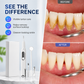 🔥Time-Limited Special💥Portable Ultrasonic Teeth Cleaner and Tartar Remover Set